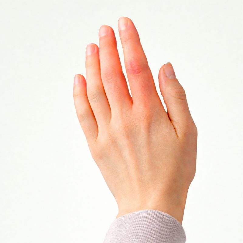 Kéz/Ujj Fájdalom