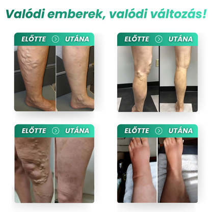 Wellive™ Lábmasszírozó